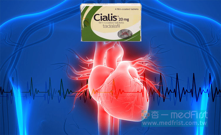 心臟病患者使用犀利士的條件與依據
